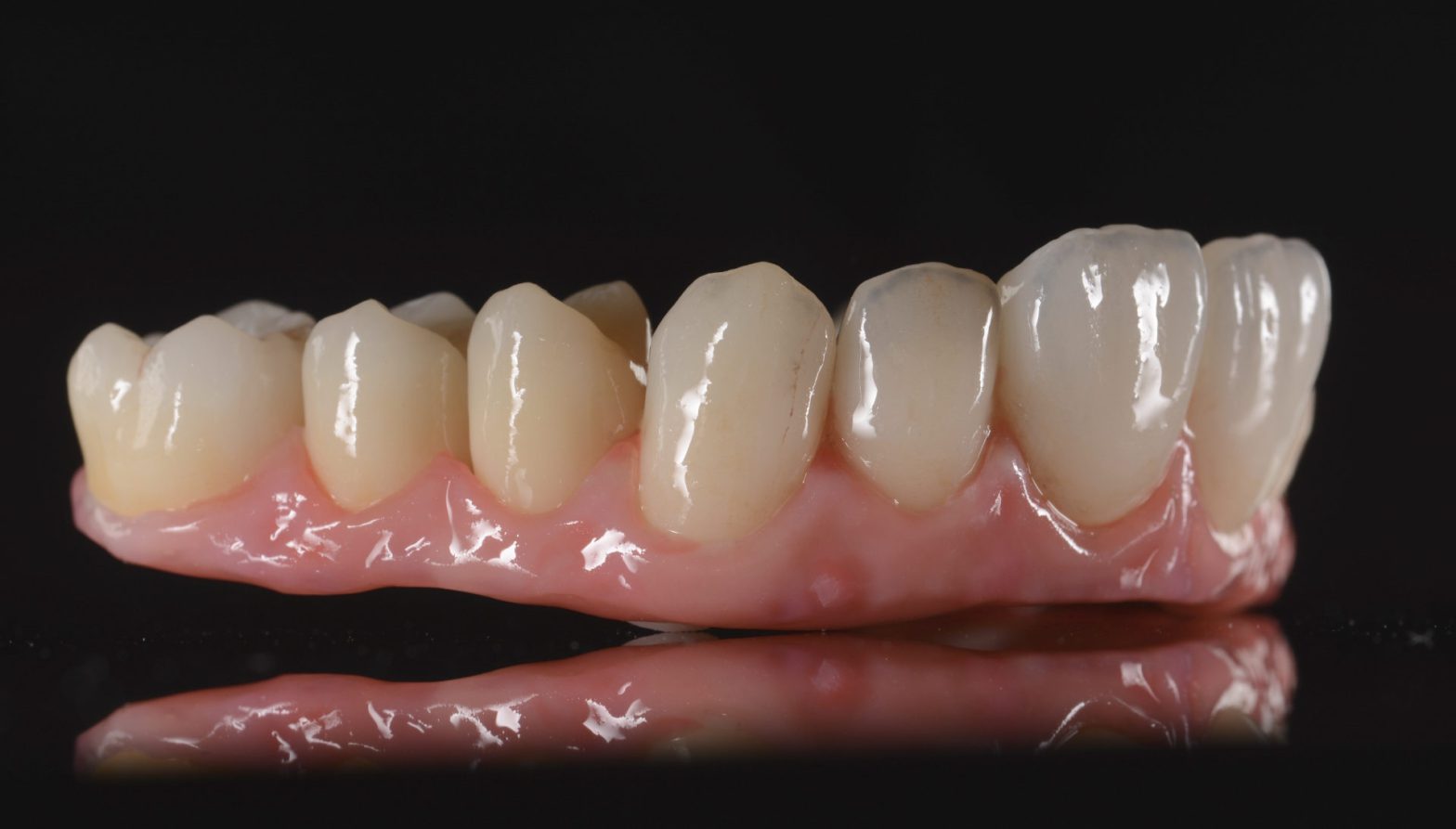100 Mpa Plus Progressive